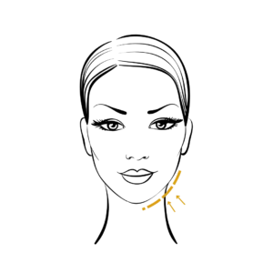 Woman's body illustration highlighting the location of the Silicone facial implants